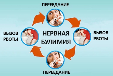 Лечение булимии в Киржаче